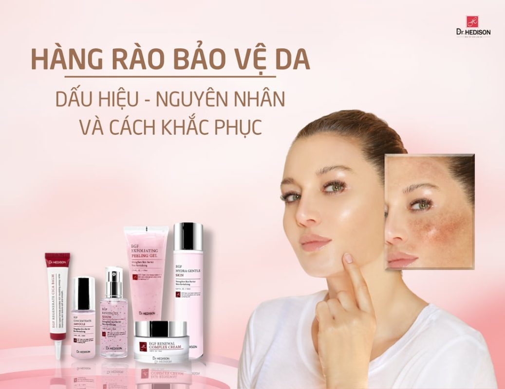 Hàng rào bảo vệ da