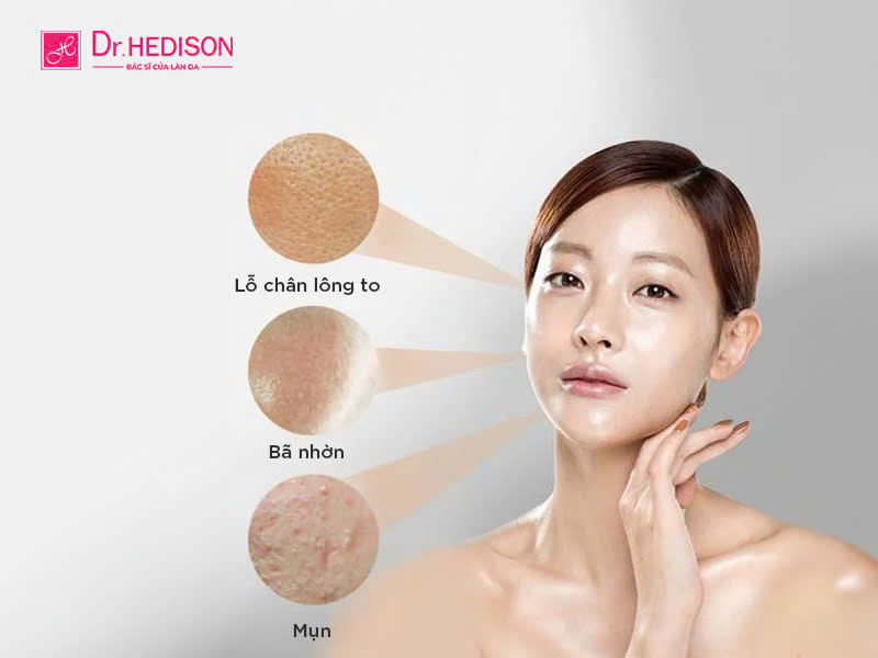 Dược mỹ phẩm cho da dầu Dr.HEDISON