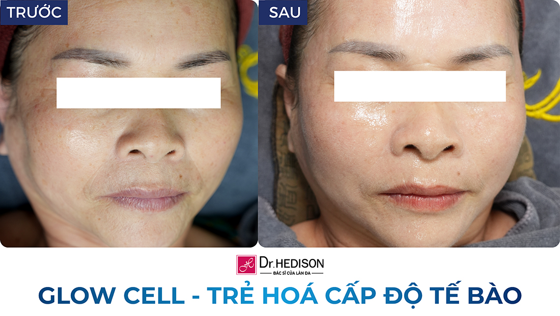 glow cell - trẻ hoá cấp độ tế bào (2)