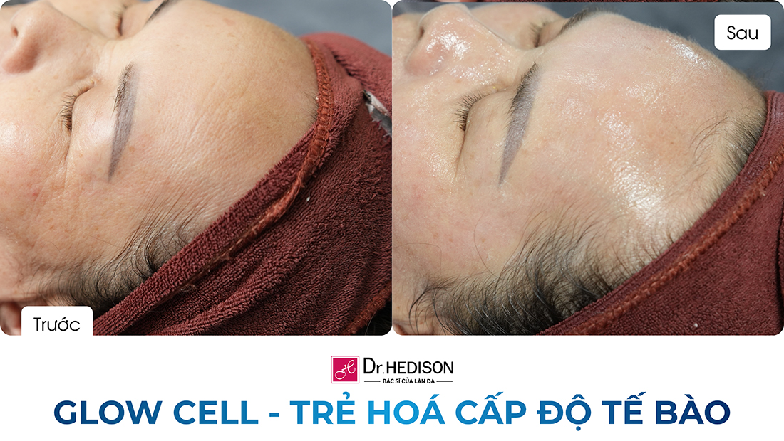 glow cell - trẻ hoá cấp độ tế bào (2)