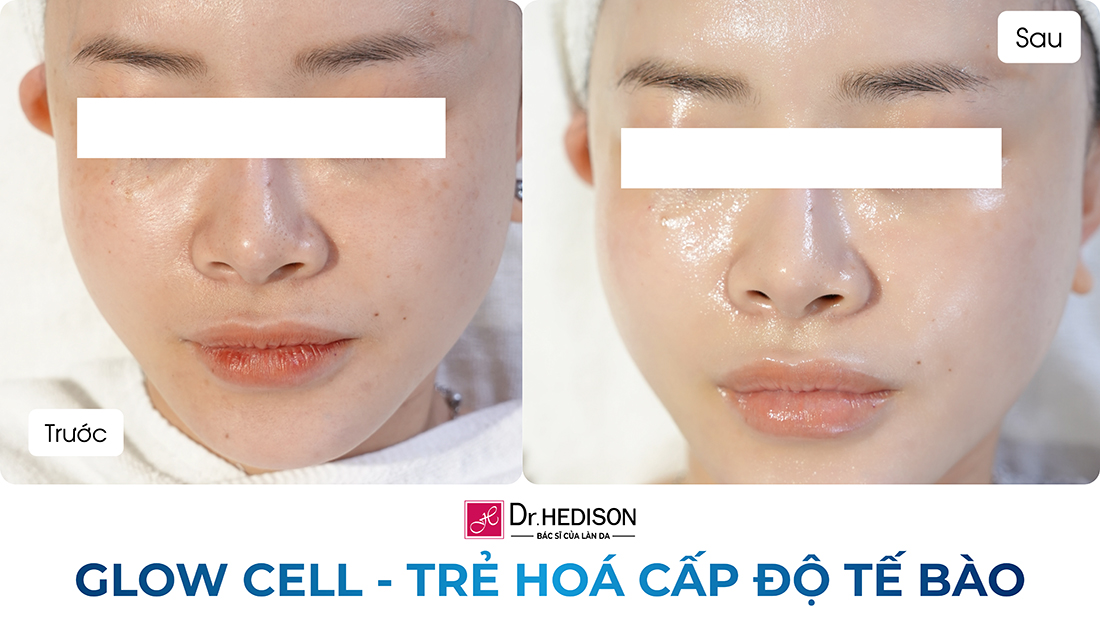 glow cell - trẻ hoá cấp độ tế bào (2)