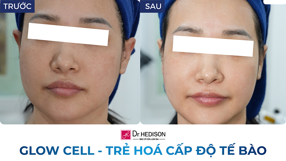 glow cell - trẻ hoá cấp độ tế bào (2)