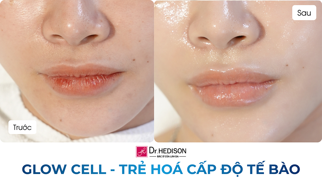 glow cell - trẻ hoá cấp độ tế bào (2)