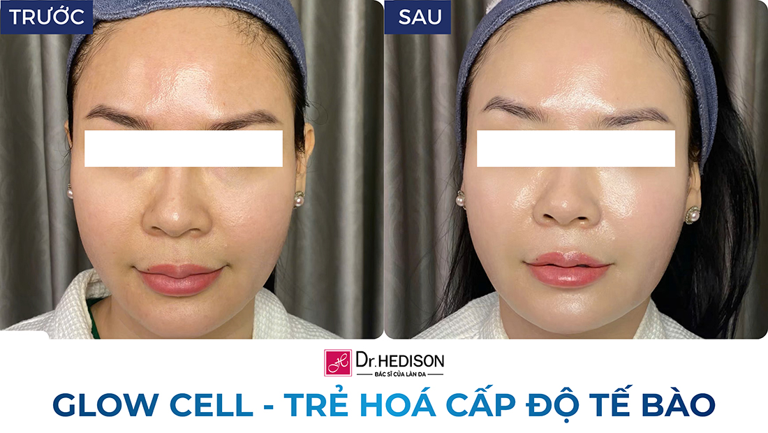 glow cell - trẻ hoá cấp độ tế bào (2)
