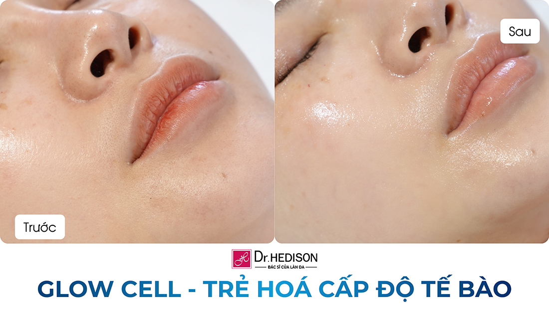 glow cell - trẻ hoá cấp độ tế bào