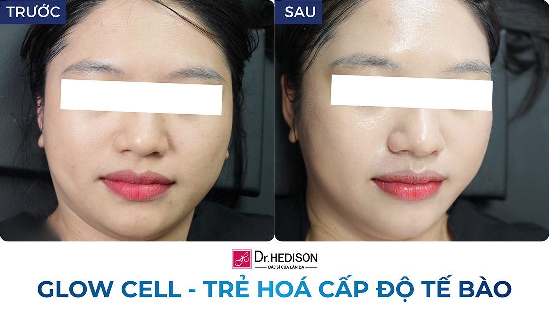 glow cell - trẻ hoá cấp độ tế bào
