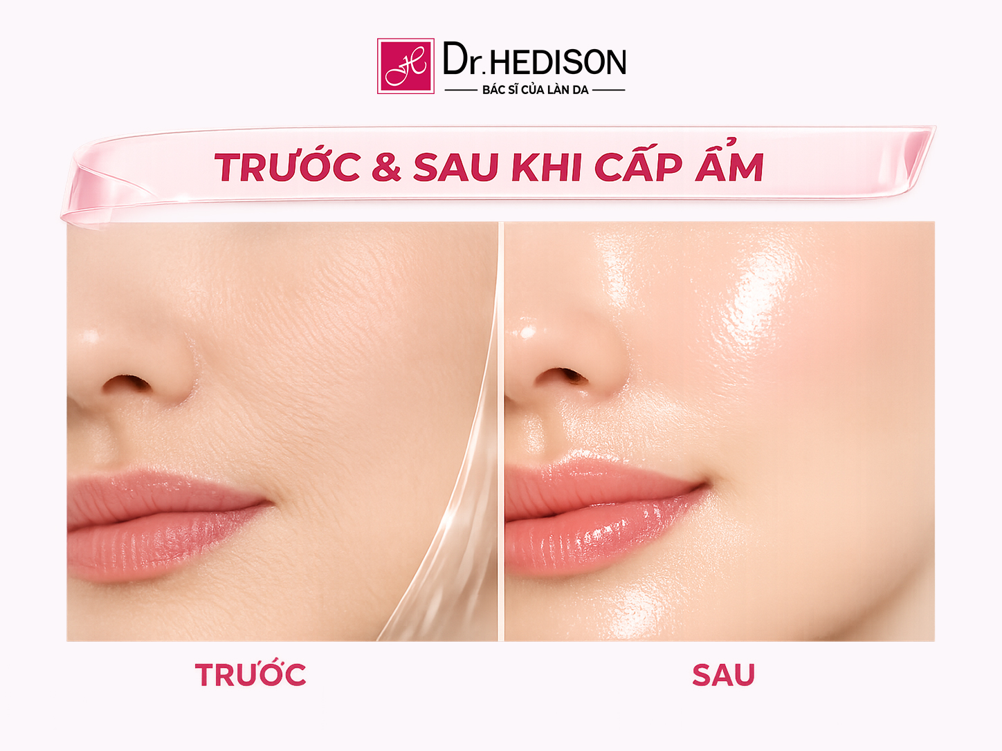 Dr.HEDISON The Premium Collagen